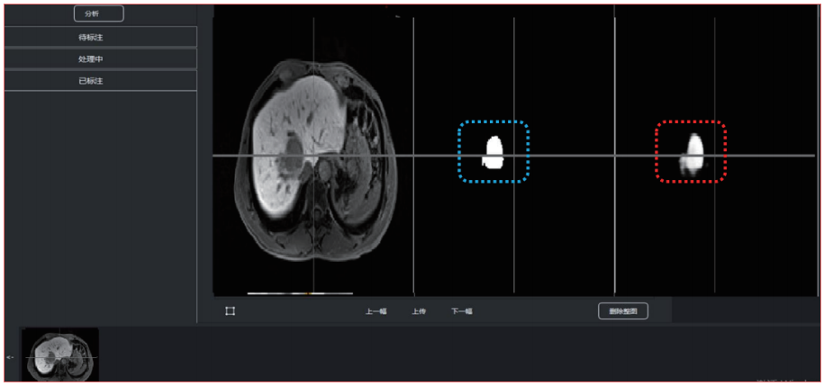 ҽ��Ӱ��AI��������